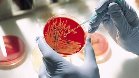 bakteriální kultivace pro prostatitidu k předepsání antibiotik