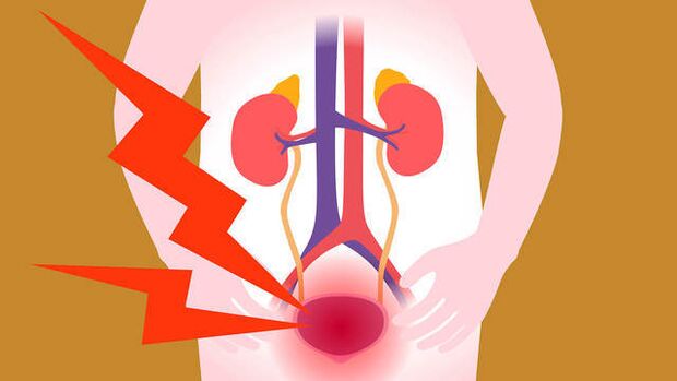 bolest v oblasti močového měchýře s akutní prostatitidou